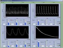 Cardio&Brain signals